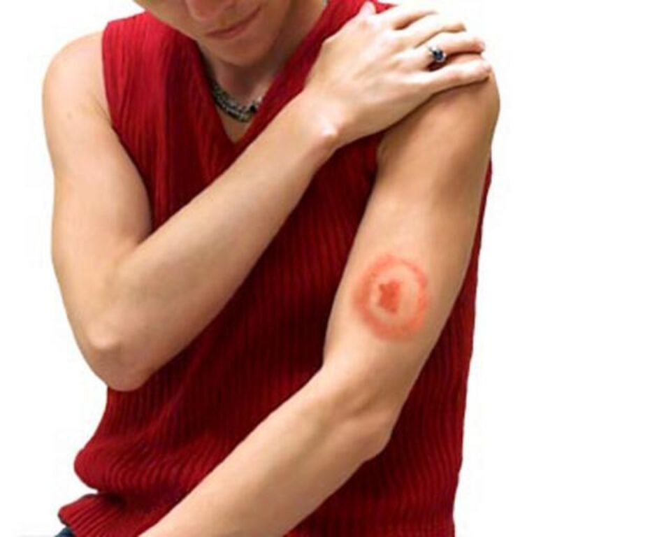 Numărul sucevenilor bolnavi sau suspecți de boala Lyme, în creștere. Foto: what-is-lyme-disease.com
