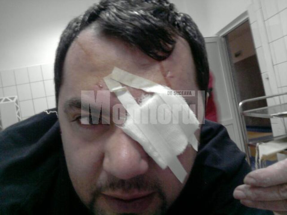 Tânărul urmează să-și scoată certificat medico-legal