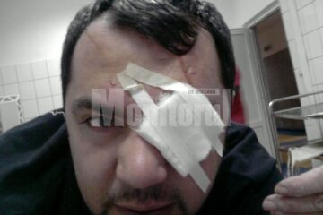 Tânărul urmează să-și scoată certificat medico-legal