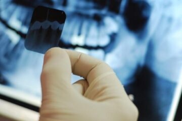 Radiografiile dentare pot cauza tumori cerebrale