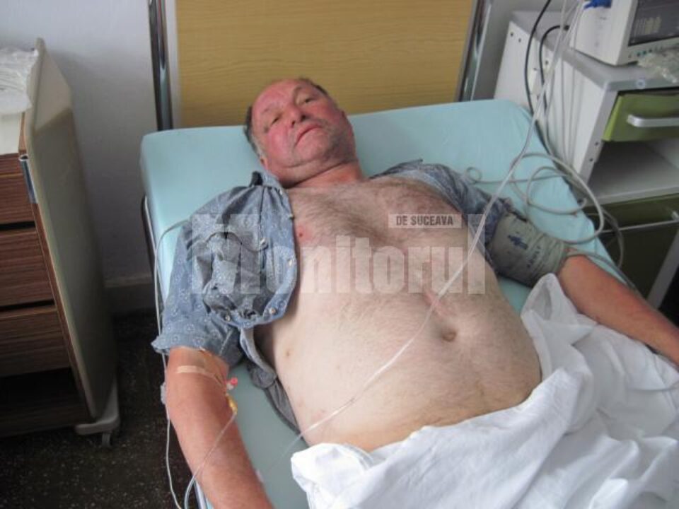 Vasile Chifan a fost internat în Spitalul Municipal Rădăuți, cu traumatism cranio-cerebral și multiple fracturi costale Vasile Chifan a fost internat în Spitalul Municipal Rădăuți, cu traumatism cranio-cerebral și multiple fracturi costale
