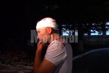Pavel Hlamagă: Am fost blocat în trafic, iar apoi m-au bătut cu bâta