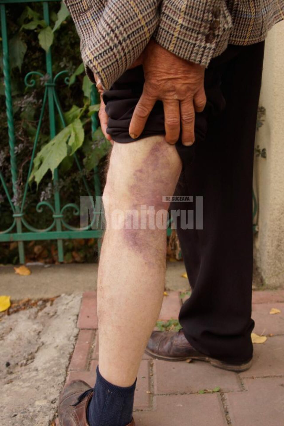 Dragoș Daniliuc și-a scos certificat medico-legal și a făcut plângere împotriva polițiștilor care l-au bătut