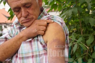Dragoș Daniliuc și-a scos certificat medico-legal și a făcut plângere împotriva polițiștilor care l-au bătut