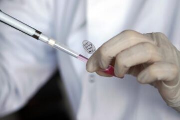 Probele recoltate pentru examenul citologic Babeș-Papanicolaou vor fi lucrate la două spitale, Suceava și Fălticeni