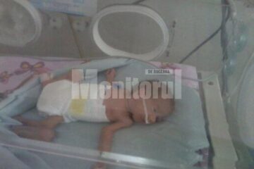 Pentru a supraviețui, prematurii sunt ținuți în incubatoare care le asigură condiții similare celor din uterul mamei