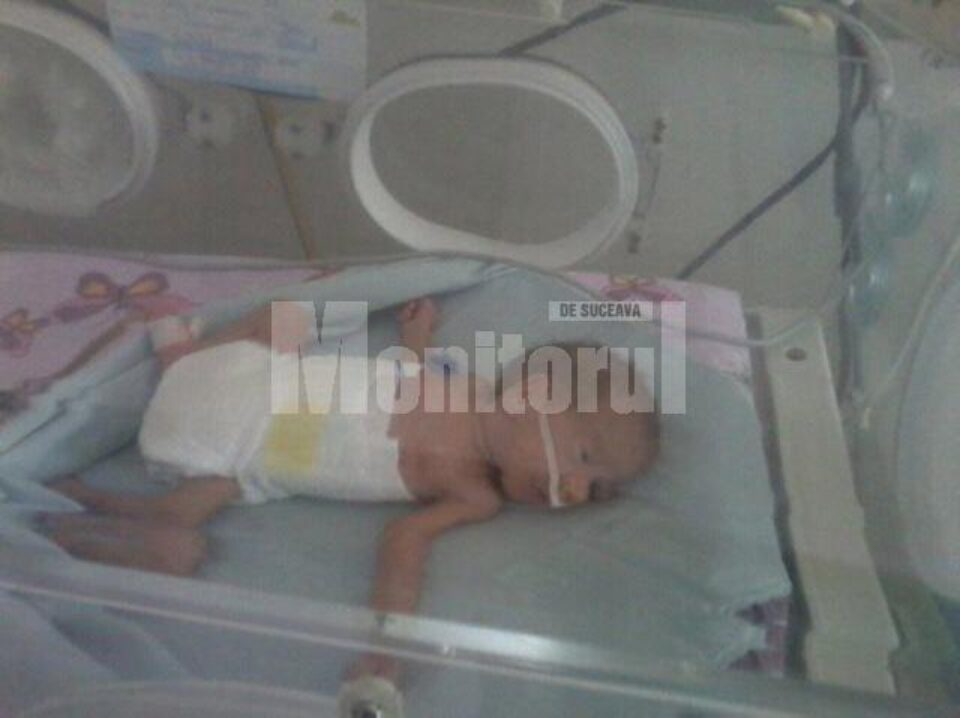 Pentru a supraviețui, prematurii sunt ținuți în incubatoare care le asigură condiții similare celor din uterul mamei Pentru a supraviețui, prematurii sunt ținuți în incubatoare care le asigură condiții similare celor din uterul mamei