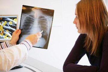 Astmul este o boală cronică de plămâni, caracterizată prin probleme recurente de respirație