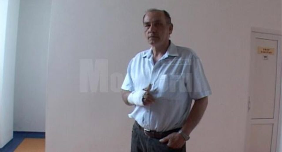 Chirurgul, Constantin Păncescu (57 de ani), a ajuns la Unitatea de Primire a Urgențelor (UPU) din cadrul Spitalului Județean Suceava cu fractură la un deget de la mâna dreaptă Chirurgul, Constantin Păncescu (57 de ani), a ajuns la Unitatea de Primire a Urgențelor (UPU) din cadrul Spitalului Județean Suceava cu fractură la un deget de la mâna dreaptă
