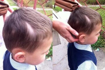 Băiețelul prezintă leziuni la nivelul capului și are nevoie de 4-5 zile de îngrijiri medicale