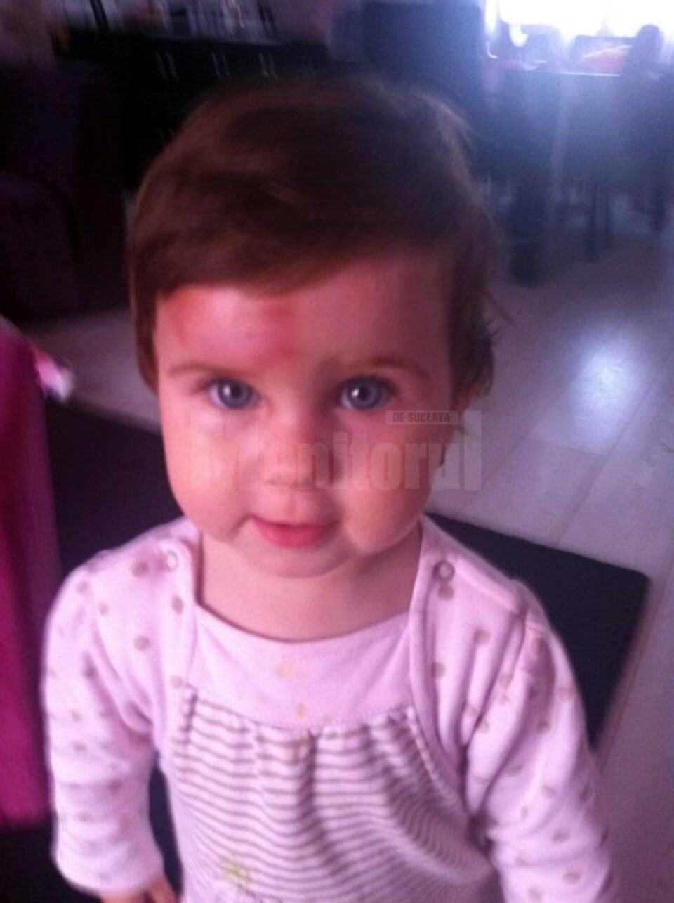 Fotografiile au fost făcute la patru zile de la incident, după ce micuței i-au fost puse comprese și foi de varză