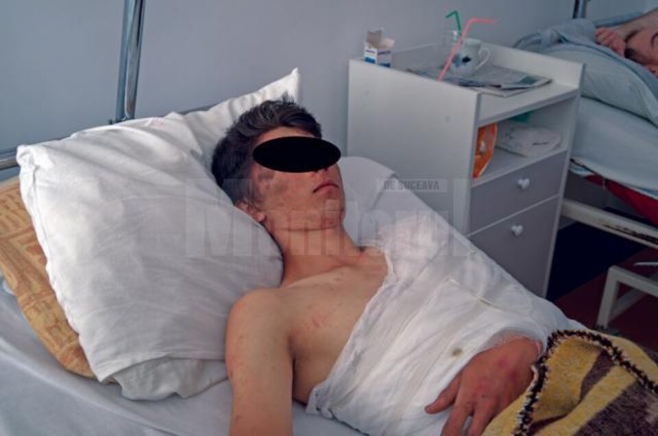 Tânărul agresat a fost adus, în noaptea de duminică spre luni, în stare gravă la Urgențele Spitalului Județean
