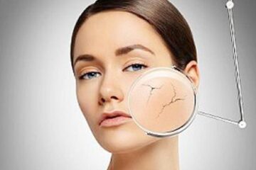 Expunerea la razele ultraviolete cauzează apariția a 80% din totalul ridurilor vizibile