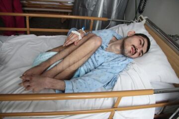 Andrei Stețco cântărește la 23 de ani doar 21 de kilograme