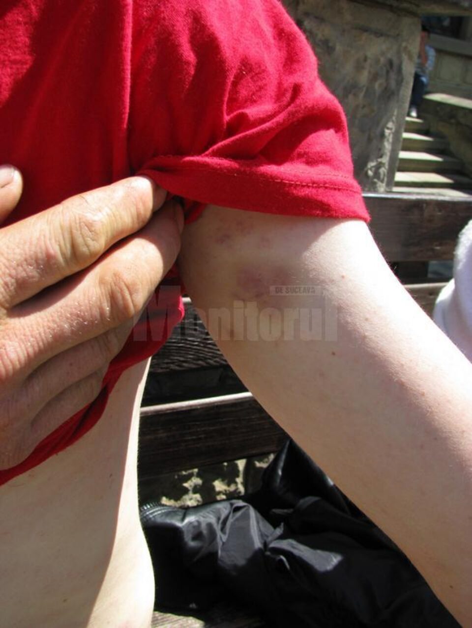 Ștefan Trisciuc are certificat medico-legal care atestă că prezintă plăgi contuze, hematoame, echimoze și excoriații care necesită 7-9 zile de îngrijiri medicale