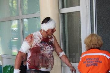 Ieri dimineață, Romică Olar a părăsit unitatea medicală pe propria răspundere, deși avea leziuni craniene și toraco-abdominale destul de serioase