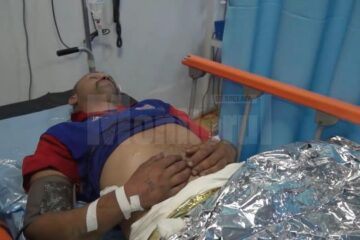 Un rom din Pătrăuți și-a turnat benzină peste el și și-a dat foc