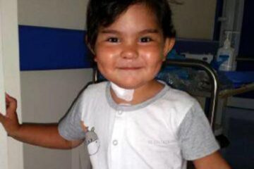 Recuperarea postoperatorie a micuței Rebeca decurge fără probleme