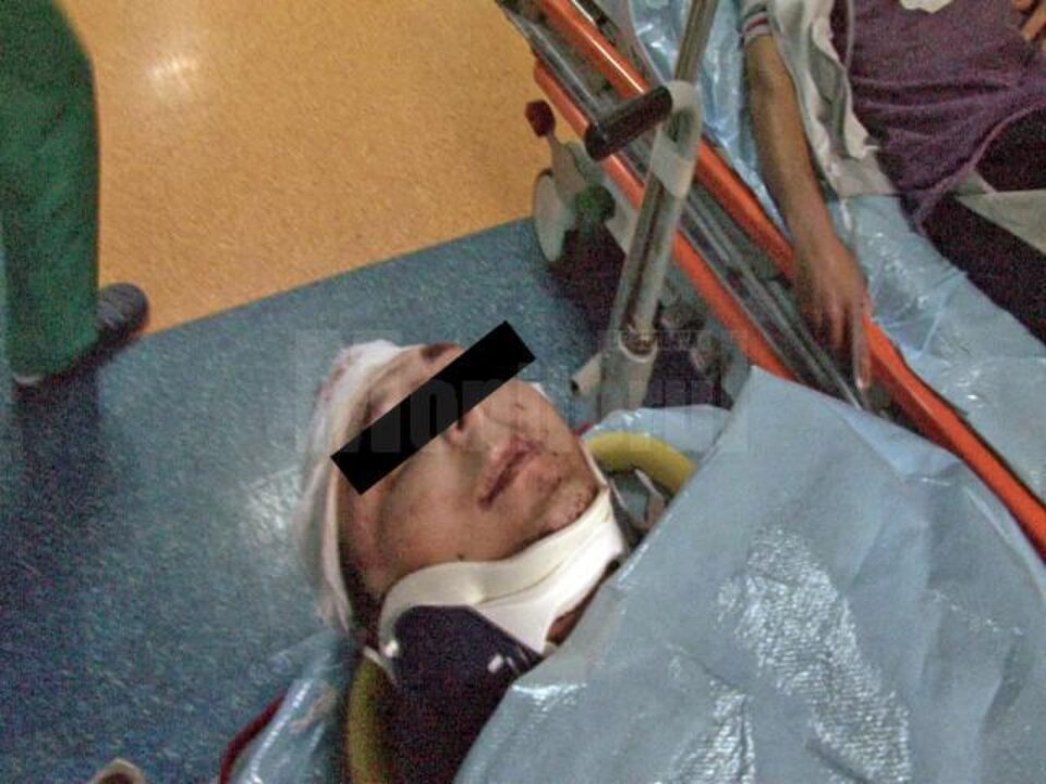 Taximetristul a ajuns la spital cu traumatism cranio-cerebral grav, multiple plăgi craniene, otoragie stângă, contuzie hemitorace stâng și multiple excoriații pe membrele inferioare