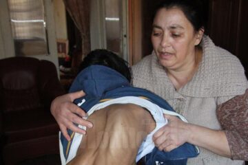 Romario Florin Matei, din municipiul Suceava, în vârstă de 16 ani, suferă de scolioză cervicală-dorsală severă, retard psihomotor sever și autism