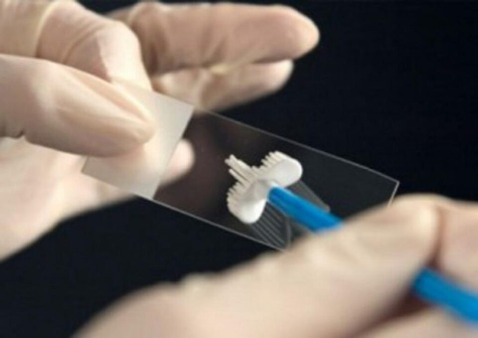 Un singur test gratuit pentru femeile între 25 și 64 de ani. Foto: Informatia-zilei.ro Un singur test gratuit pentru femeile între 25 și 64 de ani. Foto: Informatia-zilei.ro