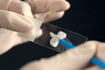Un singur test gratuit pentru femeile între 25 și 64 de ani. Foto: Informatia-zilei.ro