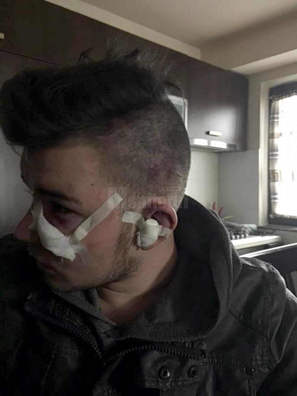 Eduard Dura a fost bătut pe stradă acum câteva săptămâni, pe motiv că face parte din gașca lui Turu
