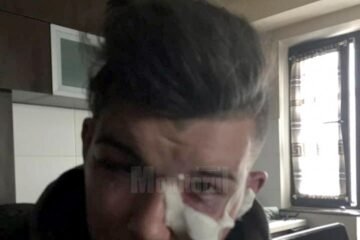 Eduard Dura a fost bătut pe stradă acum câteva săptămâni, pe motiv că face parte din gașca lui Turu