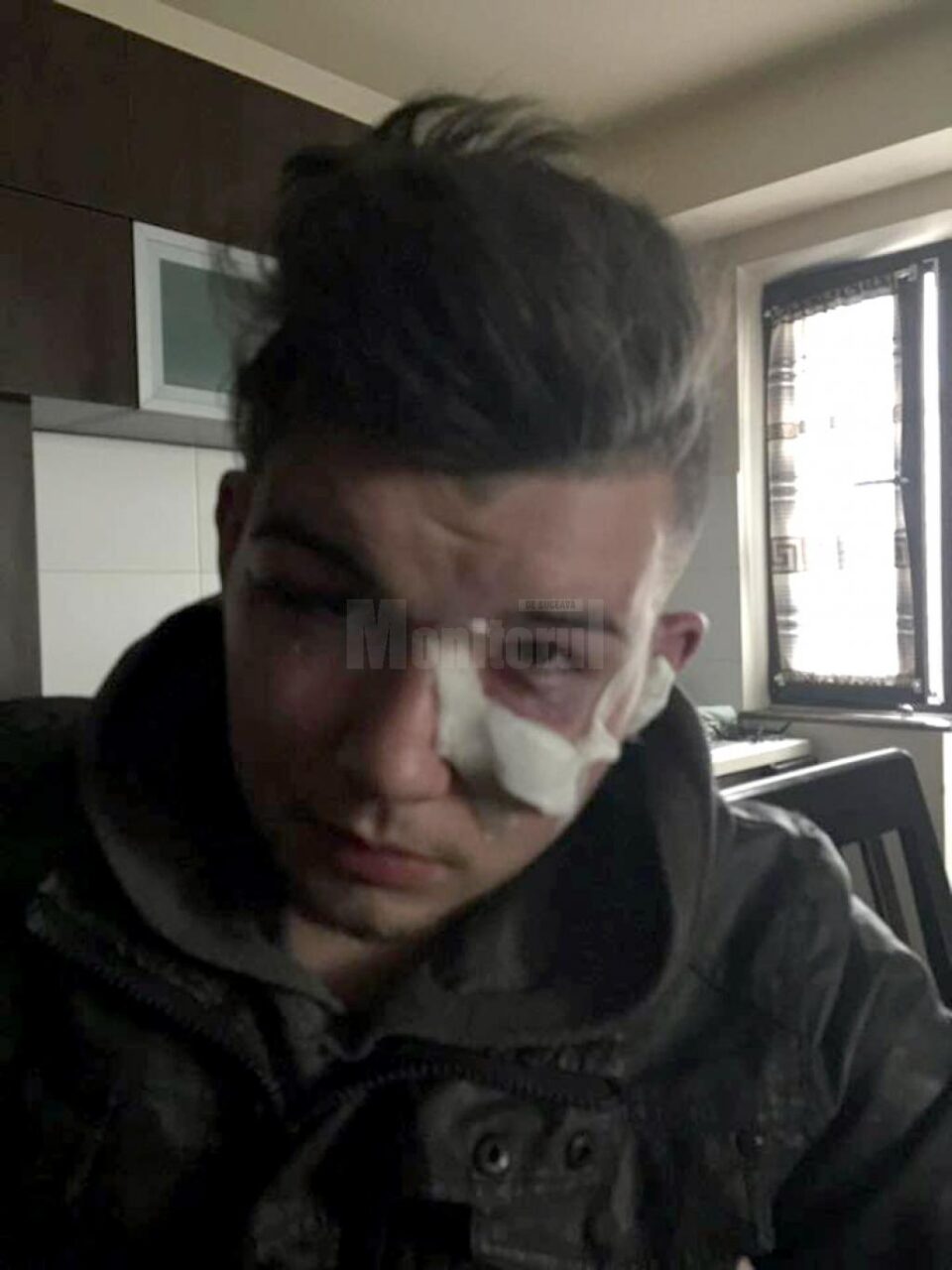 Eduard Dura a fost bătut pe stradă acum câteva săptămâni, pe motiv că face parte din gașca lui Turu Eduard Dura a fost bătut pe stradă acum câteva săptămâni, pe motiv că face parte din gașca lui Turu