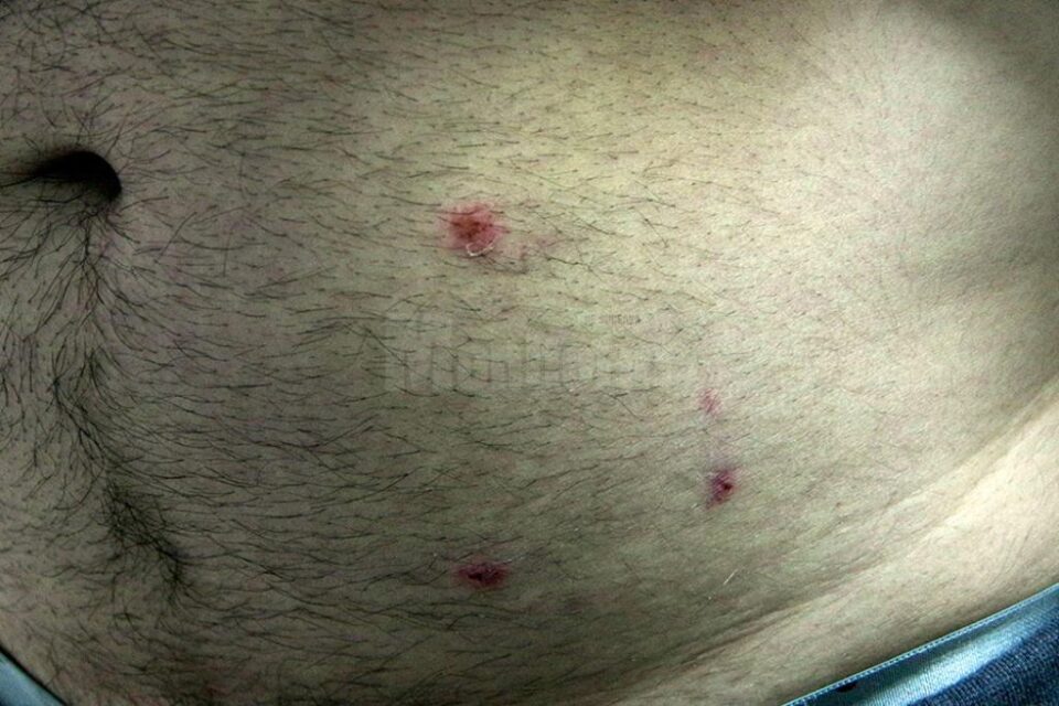 Victima are mai multe plăgi mușcate