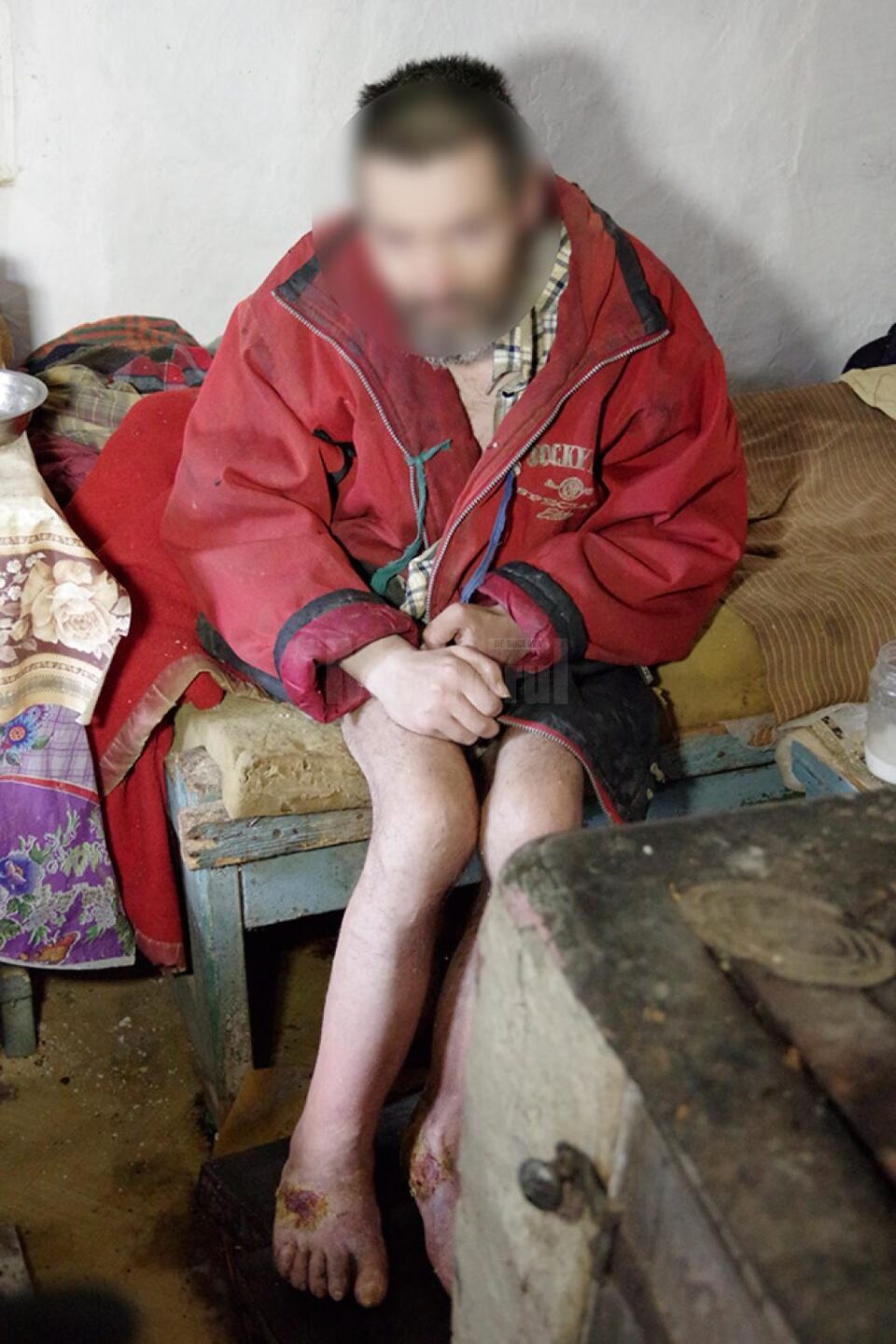 Bărbatul se află într-o stare foarte precară, care necesită intervenție medicală de urgență, au constatat specialiștii