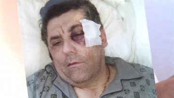 Familia lui Iosep Constantin Axentioi a prezentat mai multe fotografii cu afaceristul în spital, după ce a fost lovit cu o rangă în cap, spun ei, chiar de către Ciprian Țăranu