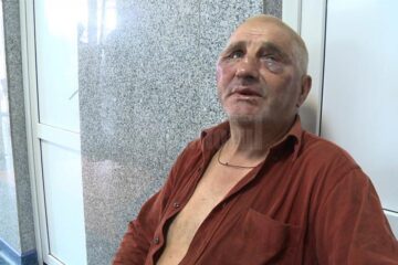 Mihai Duțuc, bărbatul de 67 de ani, ajuns cu fața tumefiată de lovituri la spital