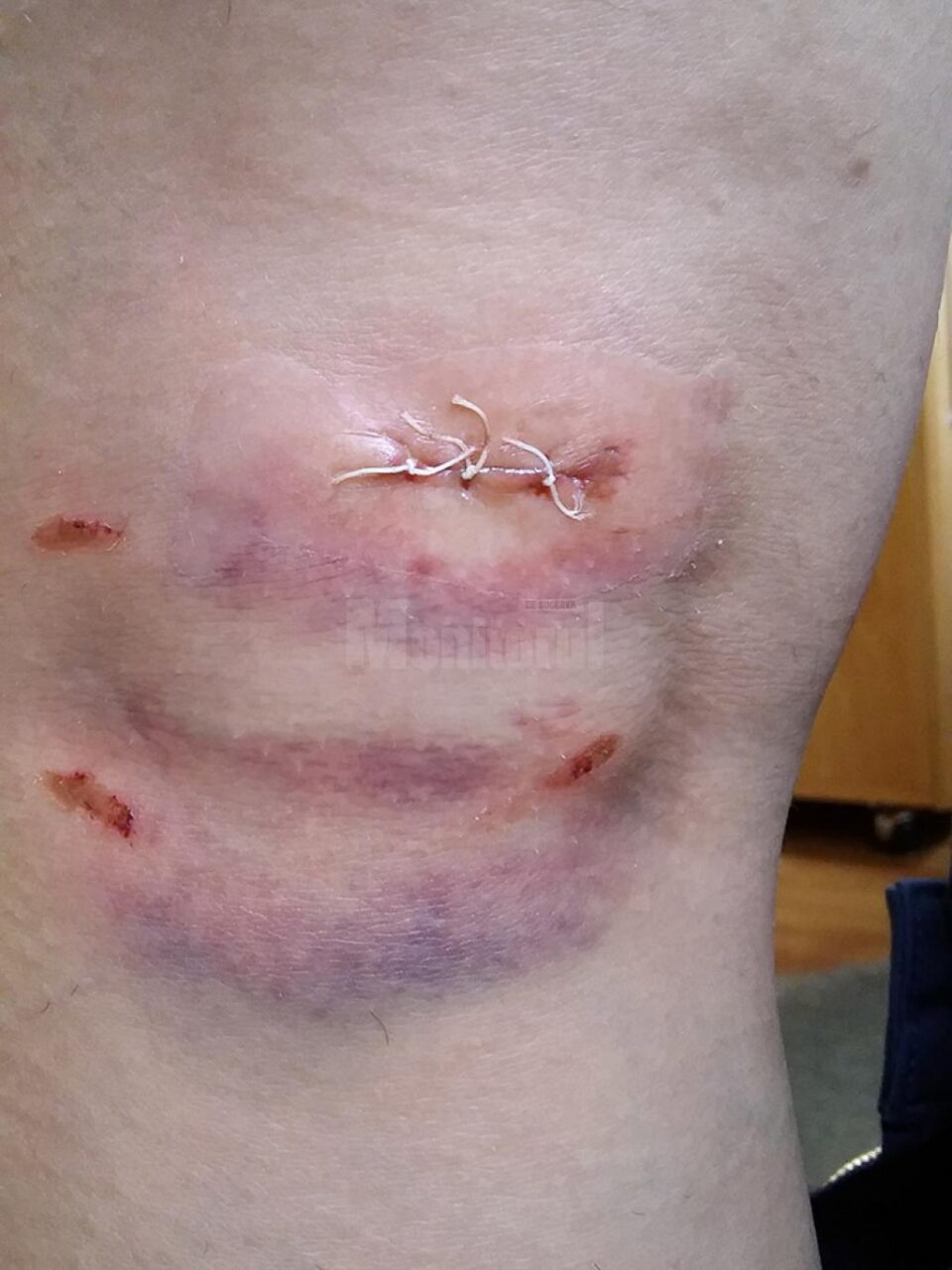 Petronela P. a fost mușcată de un maidanez joi, 22 septembrie, în jurul orei 18.00, în cartierul George Enescu