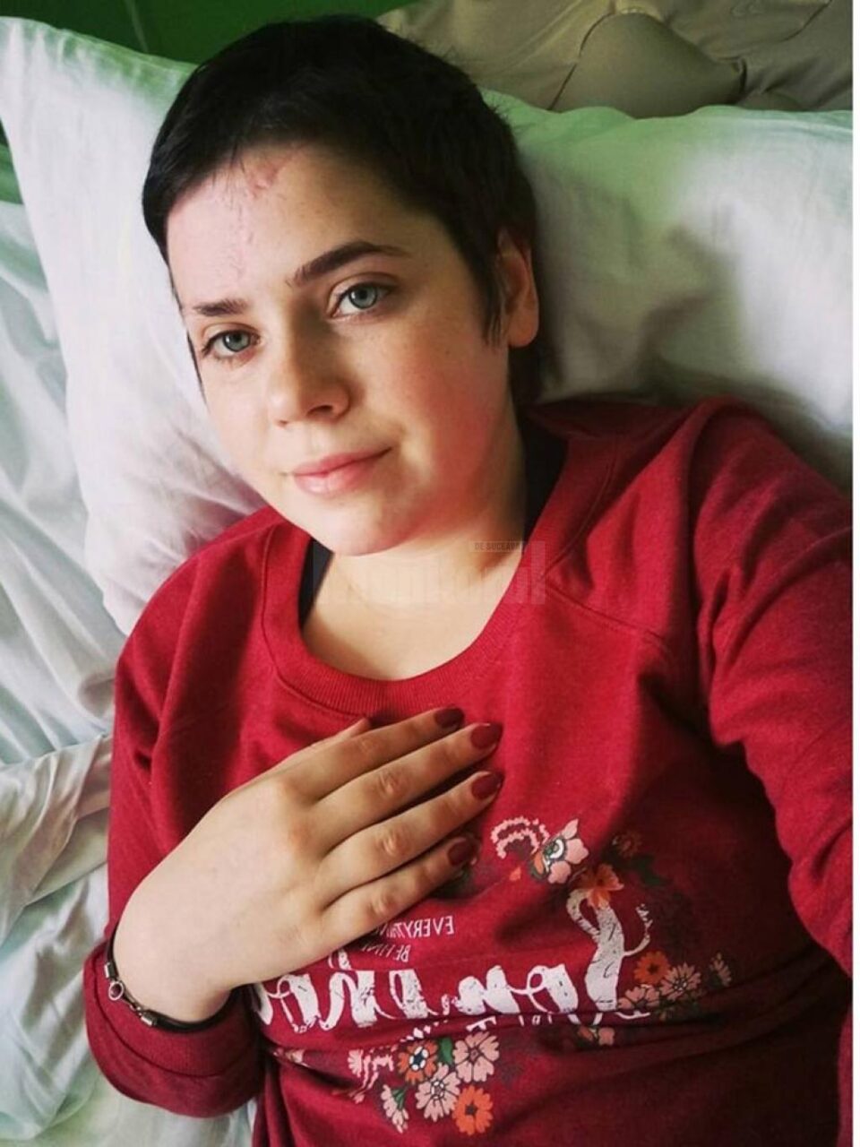 Ioana Sorina Amariței, în vârstă de 18 ani, are nevoie de ajutorul oamenilor pentru a putea păși din nou