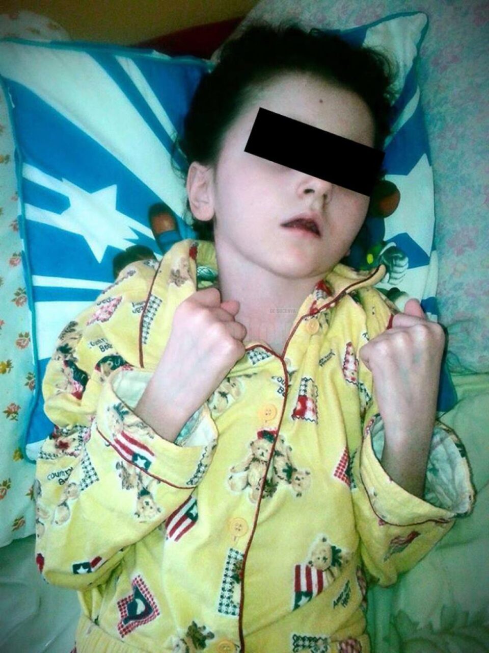 Adina Ortoanu, fetița care a rămas paralizată în urma accidentului de pe 15 ianuarie 2013