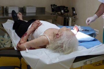 Femeia a avut nevoie de mai multe intervenții chirurgicale în urma agresiunii