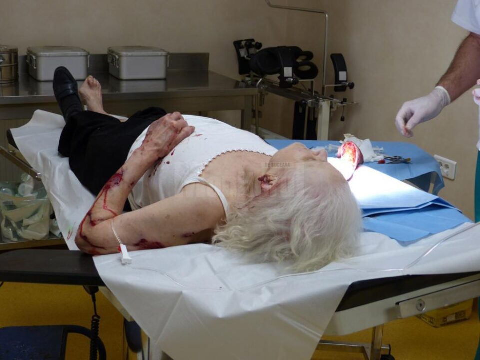 Femeia a avut nevoie de mai multe intervenții chirurgicale în urma agresiunii