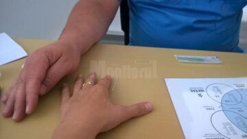 Un medic specializat în acupunctură le garantează sucevenilor că-i scapă de dureri de cap, migrene sau alergii cu ajutorul acelor