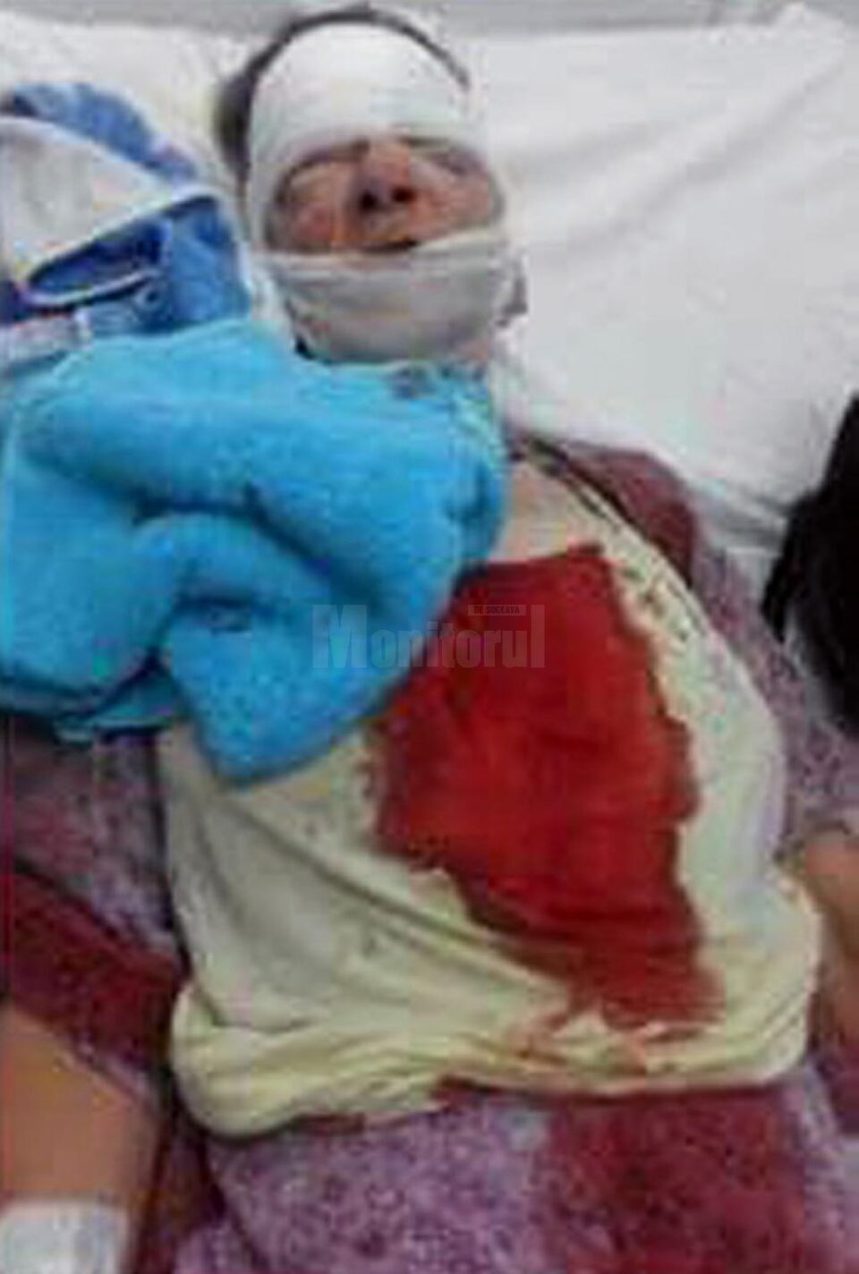 Viorica Bucătaru a ajuns în stare gravă la spital, după care a fost operată de urgență într-o clinică din Iași