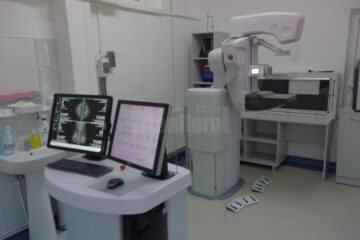 Cel mai nou mamograf achiziționat de Spitalul de Urgență Suceava