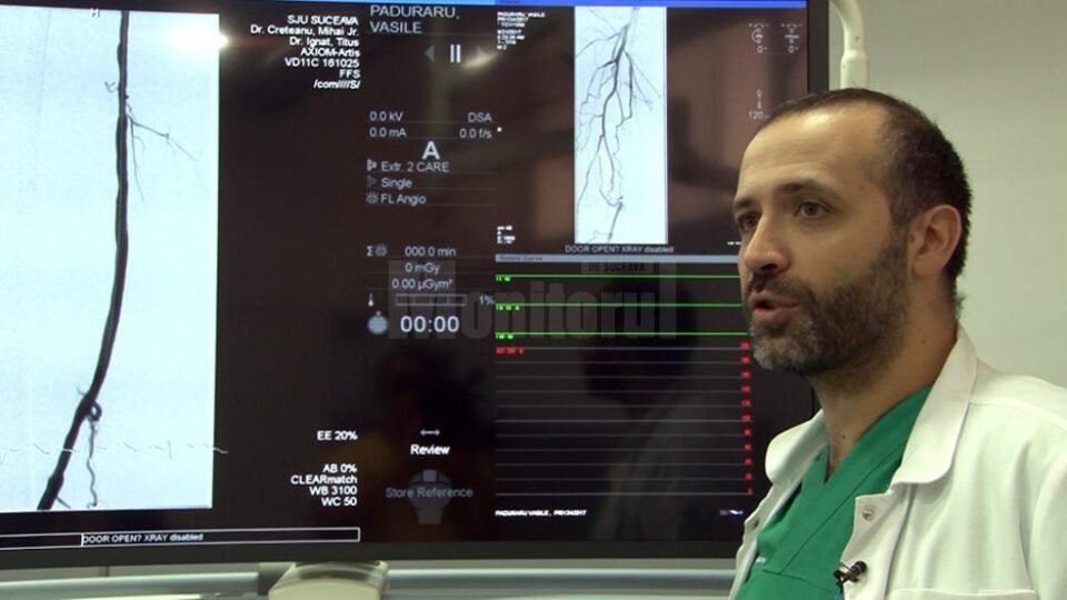 Crețeanu explică cum se desfundă vasele blocate în cazul arteritei