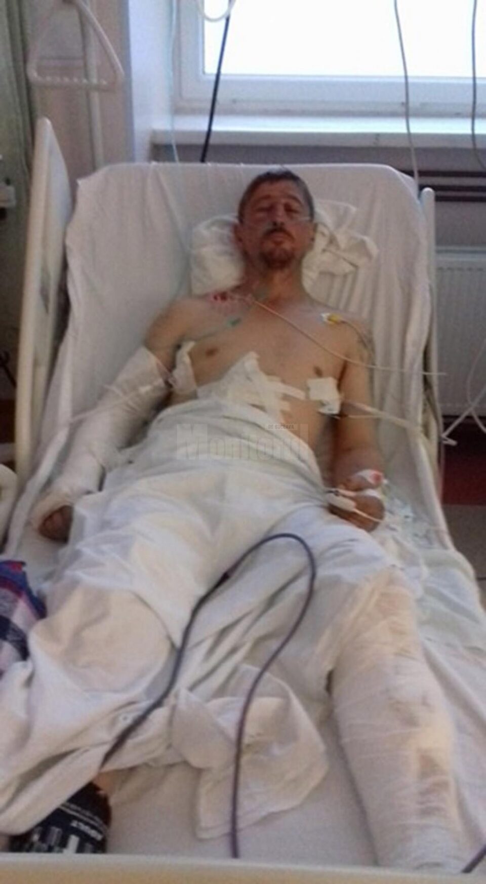 Gavriluț Flocea a ajuns în stare gravă duminică seara la spital, după ce a fost bătut cu bestialitate de câțiva indivizi