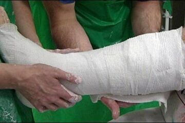 În trei zile cu zăpadă, 38 de oameni au avut nevoie de îngrijiri medicale, după căderi pe gheață