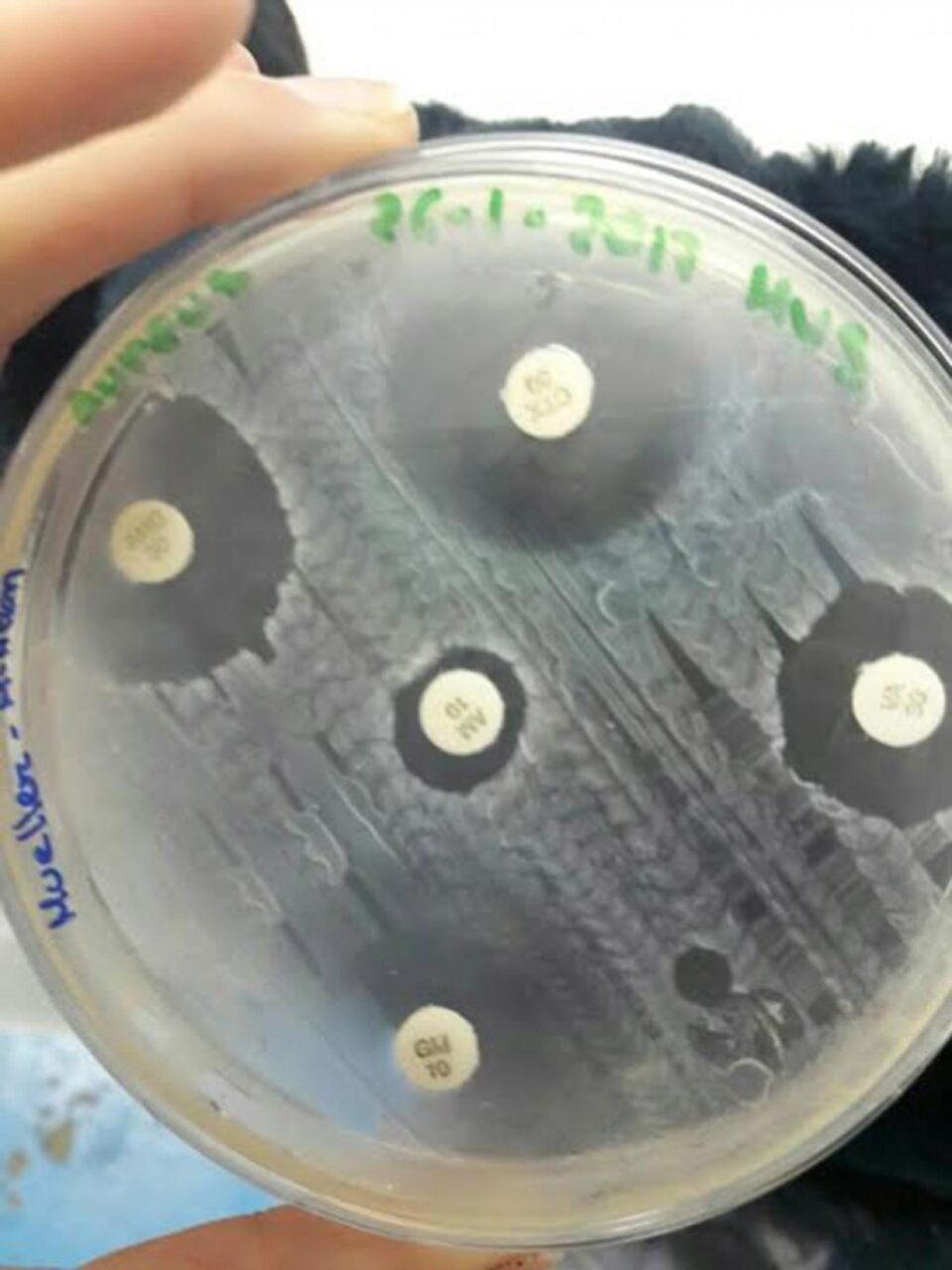 Antibiograma. Foto: microbiolofia 2017