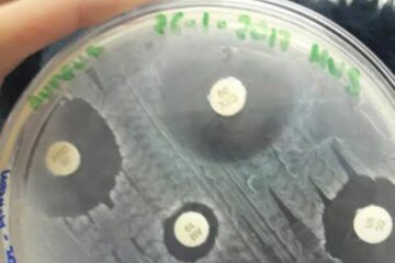 Antibiograma. Foto: microbiolofia 2017