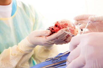 Transplant de inimă. Foto: austria center viena