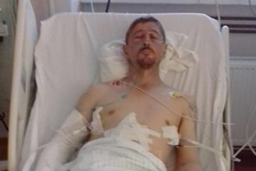 Gavriluț Flocea a încasat în 2017 o bătaie soră cu moartea, suferind multiple leziuni grave