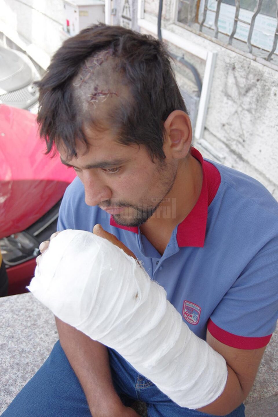 Așa arăta victima după externarea din spital