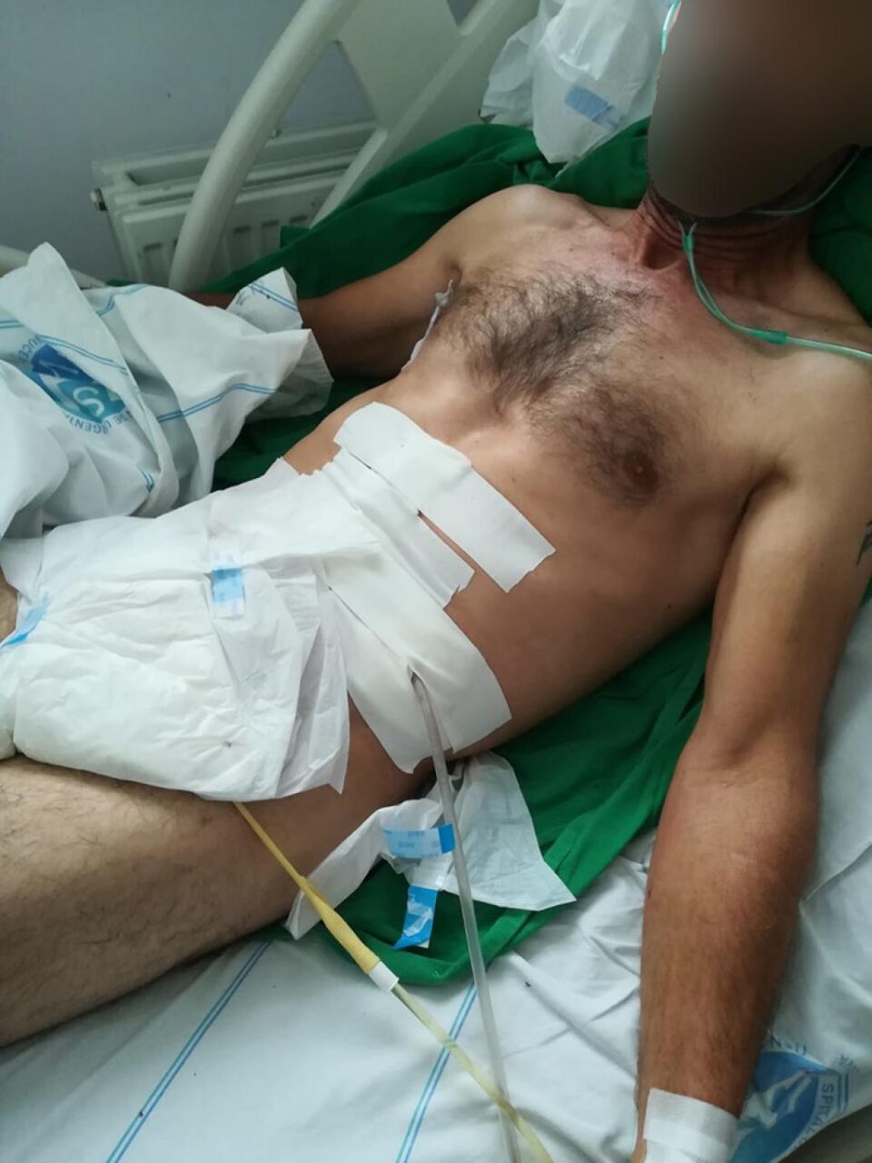 Victima agresiunii sălbatice